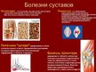 Prezentācija 'Суставы', 9.