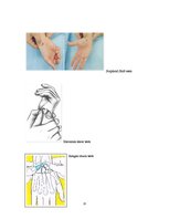 Referāts 'Karpālo saišu nestabilitāte', 13.