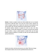 Referāts 'Gremošanas sistēma un stomas', 14.