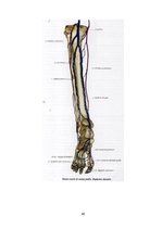 Referāts 'Apakšējo ekstremitāšu asinsrite un biežākie asins apgādes traucējumi', 32.