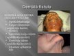 Prezentācija 'Mutes dobuma infekcijas', 15.