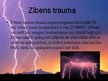 Prezentācija 'Zibens trauma', 2.