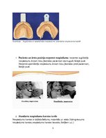 Referāts 'Izņemamās parciālās protēzes ar plastmasas bāzi klīniskie laboratoriskie posmi, ', 5.