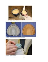 Referāts 'Izņemamās parciālās protēzes ar plastmasas bāzi klīniskie laboratoriskie posmi, ', 8.