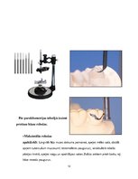 Referāts 'Izņemamās parciālās protēzes ar plastmasas bāzi klīniskie laboratoriskie posmi, ', 12.