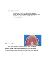 Referāts 'Izņemamās parciālās protēzes ar plastmasas bāzi klīniskie laboratoriskie posmi, ', 14.