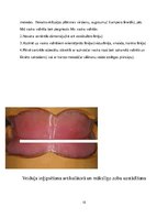Referāts 'Izņemamās parciālās protēzes ar plastmasas bāzi klīniskie laboratoriskie posmi, ', 15.