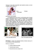 Konspekts 'Auss uzbūve, infraskaņa, ultraskaņa', 7.