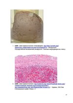 Konspekts 'Kolokvija kļūdu labojums', 17.