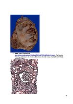 Konspekts 'Kolokvija kļūdu labojums', 18.