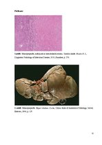 Konspekts 'Kolokvija kļūdu labojums', 32.