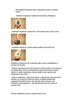 Referāts 'Karpālā kanāla sindroms - rehabilitācija', 7.