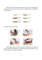 Prezentācija 'Noslēdzošā apstrāde', 5.