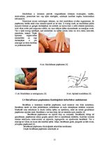 Referāts 'Masāžas paņēmienu fizioloģiskās iedarbības mehānismi', 14.
