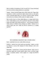 Referāts '"Sly" sindroms', 7.