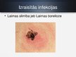 Prezentācija 'Baktērija Borrelia burgdorferi', 5.