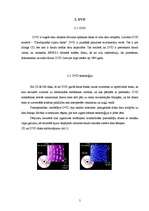 Referāts 'CD, DVD un Blu-Ray tehnoloģijas', 5.