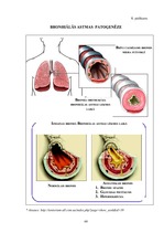 Diplomdarbs 'D.Oremas teorijas pielietojums bronhiālās astmas pacientu aprūpē', 68.
