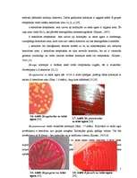 Referāts 'Ģints "streptococcus" mikroorganismu izolēšana no patoloģiskā materiāla un ident', 7.
