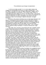 Eseja 'The worldwide issue of organ transplantation', 1.