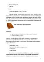 Referāts 'Jaunākās tendences grunts nostiprināšanā', 10.