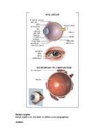 Referāts 'Acis', 4.
