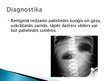 Prezentācija 'Pylorus stenoze', 17.