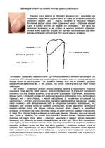 Referāts 'Фимоз у юношей', 1.