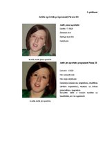 Referāts 'Attēlu kvalitāte', 24.