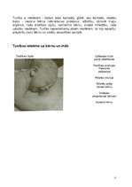 Referāts 'Priekšlaicīgas jeb pirmstermiņa dzemdības. Priekšlaikus dzimis bērns', 17.