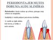 Prezentācija 'Mutes dobuma veselība', 29.