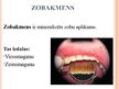Prezentācija 'Mutes dobuma veselība', 37.