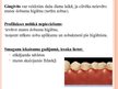 Prezentācija 'Mutes dobuma veselība', 52.