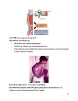 Konspekts 'Kaulu tuberkuloze', 11.