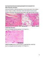 Konspekts 'Kaulu tuberkuloze', 13.