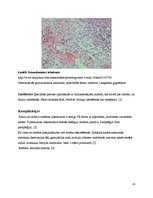 Konspekts 'Kaulu tuberkuloze', 14.