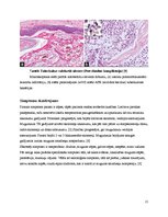Konspekts 'Kaulu tuberkuloze', 15.
