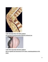 Konspekts 'Kaulu tuberkuloze', 19.