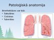 Prezentācija 'Bronhektāzes', 3.