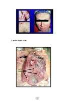 Referāts 'Tabakas kaitīgā ietekme uz cilvēka organismu', 32.