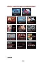 Referāts 'Tabakas kaitīgā ietekme uz cilvēka organismu', 35.