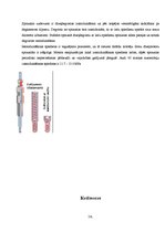 Konspekts 'Dīzeļdzinēja barošanas sistēma', 14.