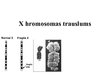 Prezentācija 'X hromosomas trauslums', 1.