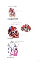 Referāts 'Iedzimtas sirdskaites', 6.