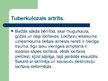 Prezentācija 'Kaulu un muskuļu sistēmas slimības', 26.
