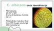 Prezentācija 'Candida albicans mikrobioloģiskās diagnostikas principi', 5.