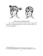 Referāts 'Hipokrāts', 17.