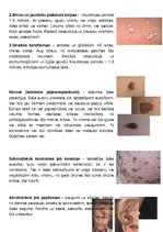 Konspekts 'Ādas audzēji', 2.