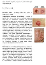 Konspekts 'Ādas audzēji', 5.