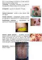 Konspekts 'Ādas audzēji', 6.